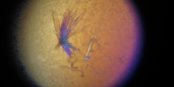 Visualizing the Molecular Interactions of an Under-diagnosed Disorder