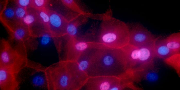 Researchers Develop an Experimental Therapy for Triple-negative Breast Cancer