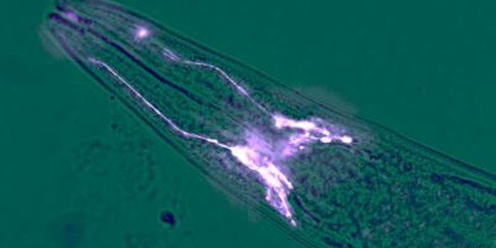 How Brain Cells Can Protect Muscles