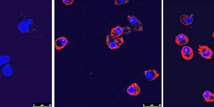 Scientists Use Gene Editing to Correct Mutation in Cystic Fibrosis