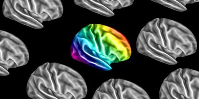 Autistic Brains May Over- or Under-Synchronize