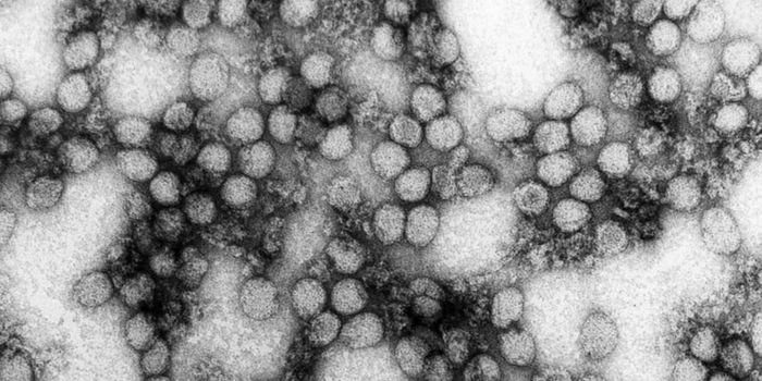 Yellow Fever Persists in Urine and Semen