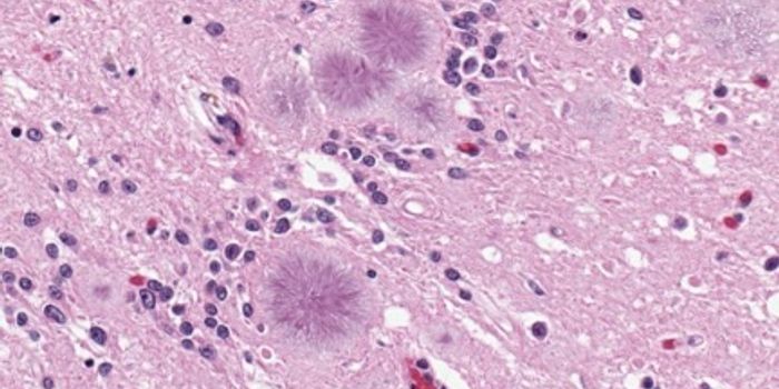 Improved Detection Of Deadly Prion Diseases