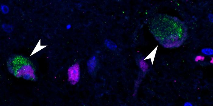 Autopsies Reveal SARS-CoV-2 in the Human Brain & Other Tissues