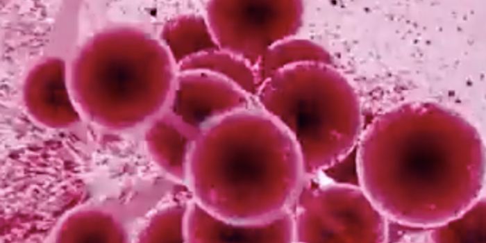 The Cause of a Rare Neurological Disease is Identified