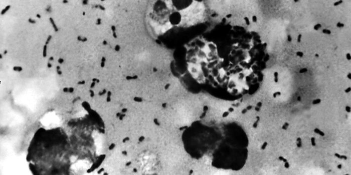 Plague Toxin Treats Common Autoimmune Disease