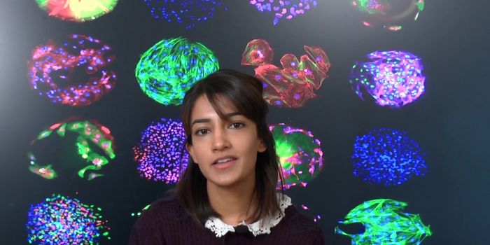 Koch Institute Image Award Winner Describes Her Science
