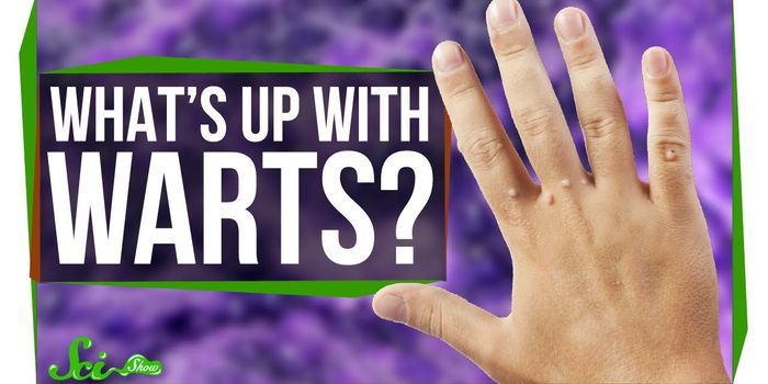 What are Warts, Anyway?