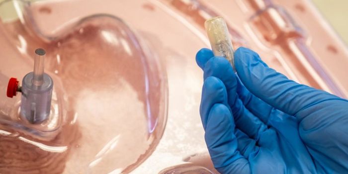 Self-Inflating Capsule To Tackle Obesity