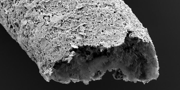 Scientists 3D Bioprint Tumor Models and Vasculature