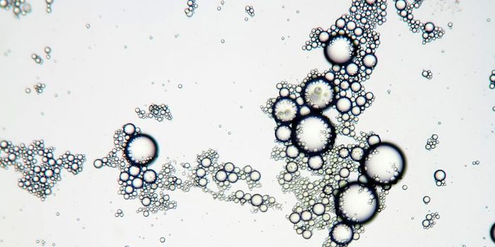 Newly-ID'ed Organelle May Play a Role in Cancer Metastasis