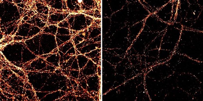 Neurons Busily Rewrite Their DNA Nonstop