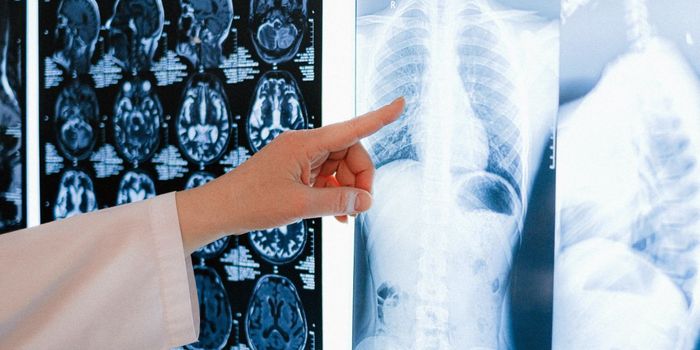 Pathogen and Drug Work Together to Fight Yeast Infection