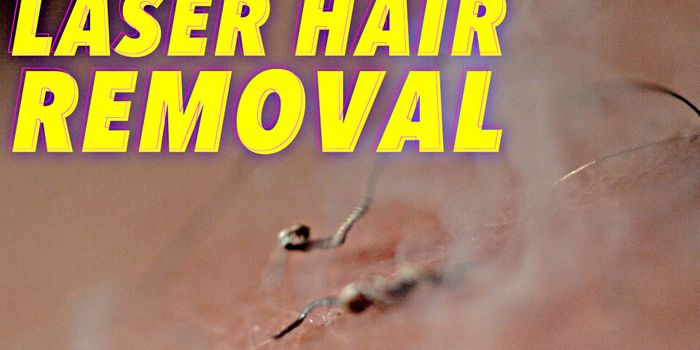 The Science of Laser Hair Removal