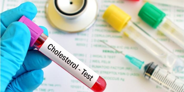 Lipoprotein Study Could Lead to Changes in Heart Disease Diagnosis