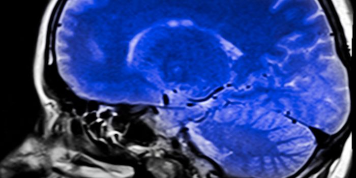 Repairing Epigenetic Imbalance may Relieve Alzheimer's