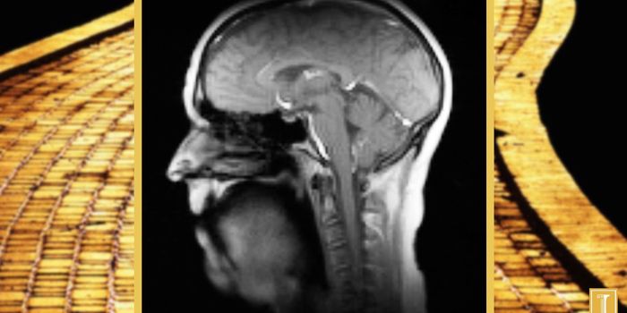 New Super-Fast MRI Technique: Singing 'If I Only Had a Brain'
