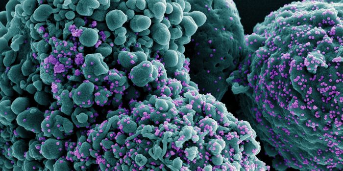 One Molecule Could Make the Difference Between Severe and Mild COVID