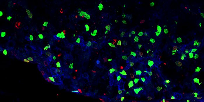 Researchers Discover Immune Cell Subtype Linked to MS and Neuroinflammation