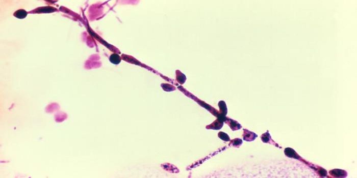 Antibodies Seem to Keep Gut Fungi in Check, Except in Crohn's Patients