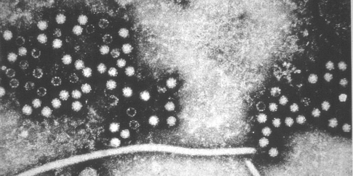 Gauging the Threat Posed by Hepatitis E