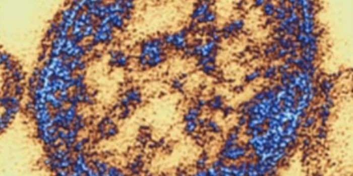 Measles Can Wipe Out the Memory of the Immune System