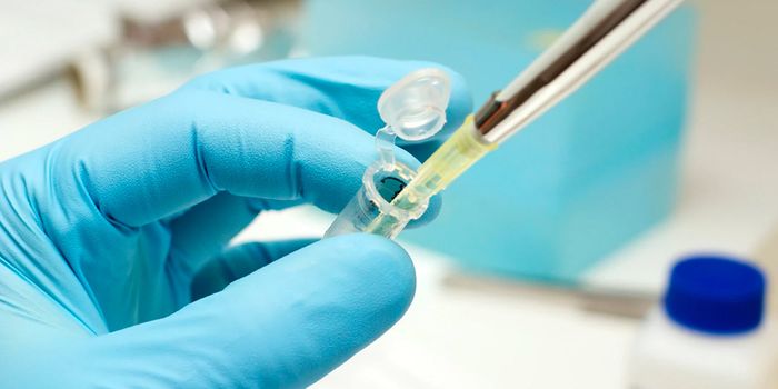 Guidance for Optimization of a Real-Time qPCR Assay