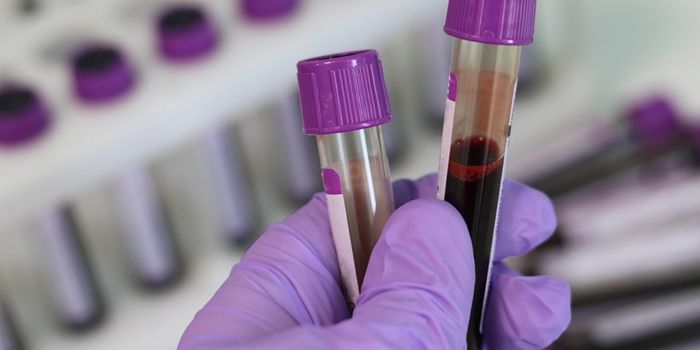 A Better Test for Measuring HIV Viral Load with Only a Drop of Blood