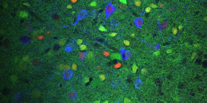 Ketamine's Restructuring of the Brain Exposed with High-Resolution Mapping