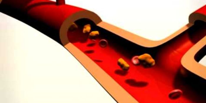 Cancer: from a healthy cell to a cancer cell