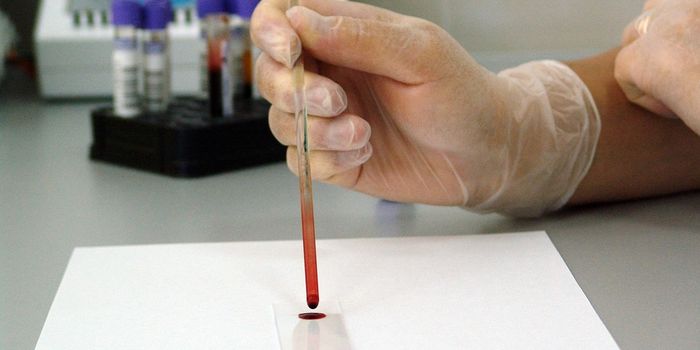 Could a blood test detect lung cancer?