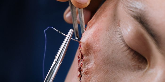 Scar-Free Healing Starts With Mobilizing the Immune System