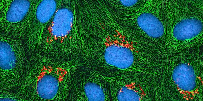 In Battle for Real Estate, a Disordered Protein Wins Out