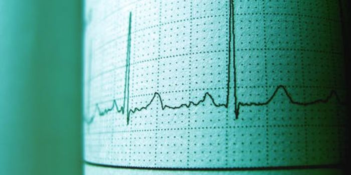 New Noninvasive Method For Controlling Atrial Fibrillation