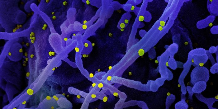 Researchers Reveal a Primary Driver of Organ Damage in COVID-19