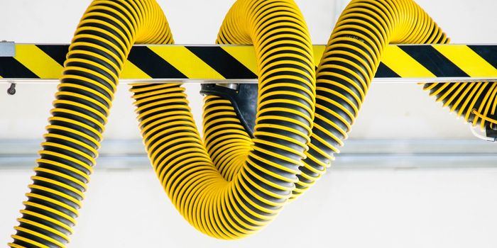 It's Not Just Cholesterol That Clogs Arteries