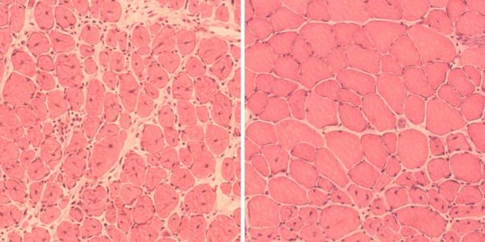 Aging in Mice Slowed Through Cellular Reprogramming