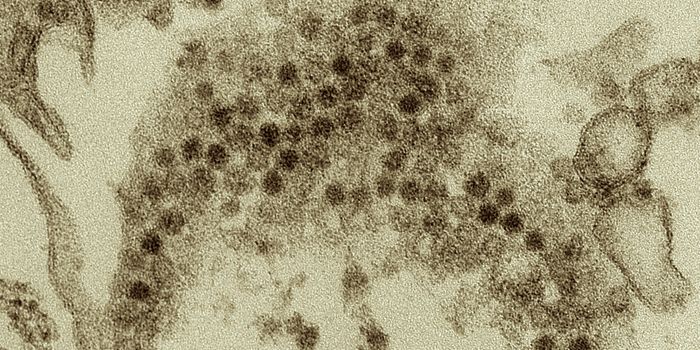 Why is Foot-and-Mouth Disease so Infectious?