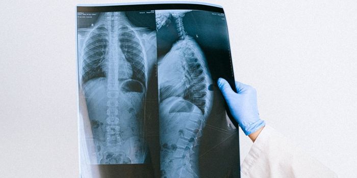 New Immunotherapy Drug Effective Against Lung Cancer