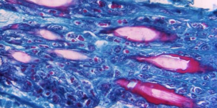 Poxvirus Made Harmless After Removing One Gene