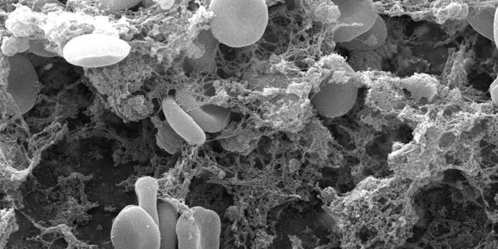 Directly Reversing the Effects of Common Anticoagulants