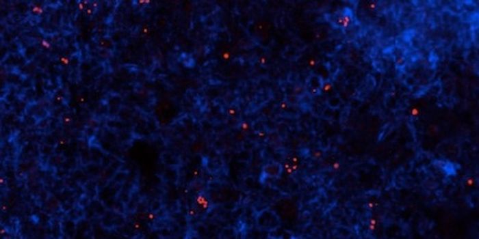 Salmonella Strains From Africa Have Evolved to be Deadlier