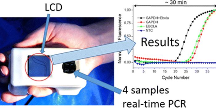 Scientists Engineer Palm-Sized Device For Ebola Detection