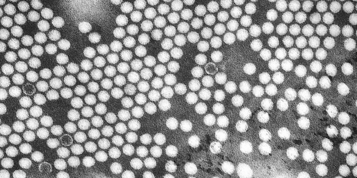 Engineered Poliovirus in Clinical Trials for Glioblastoma