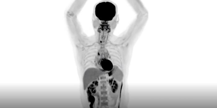 EXPLORER - Whole-Body Diagnostic Scans in About 30 Seconds