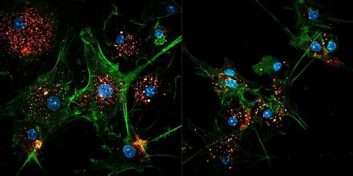 Enhancing Dendritic Cells to Fight Cancer