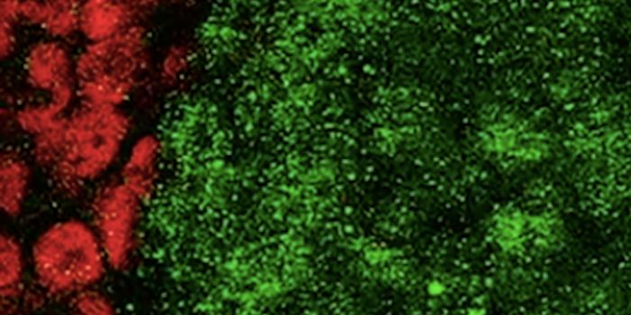 Award-winning Images of Organoids From the Koch Institute