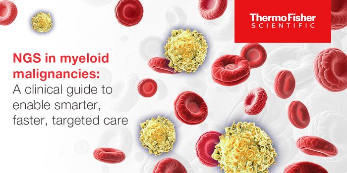 Clinical guide for myeloid molecular testing with rapid NGS