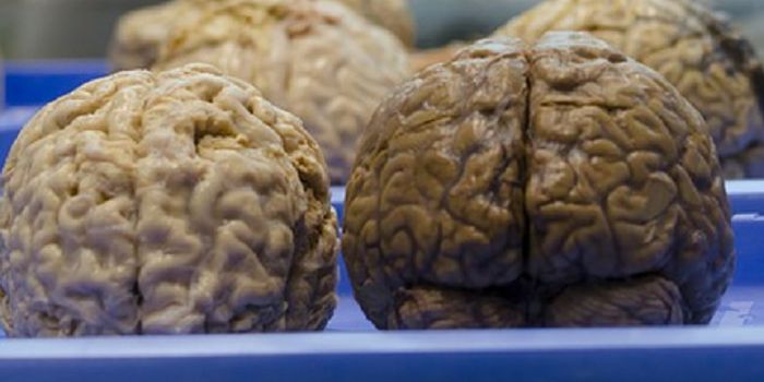 Some Ways of Healing the Brain Actually Damage It