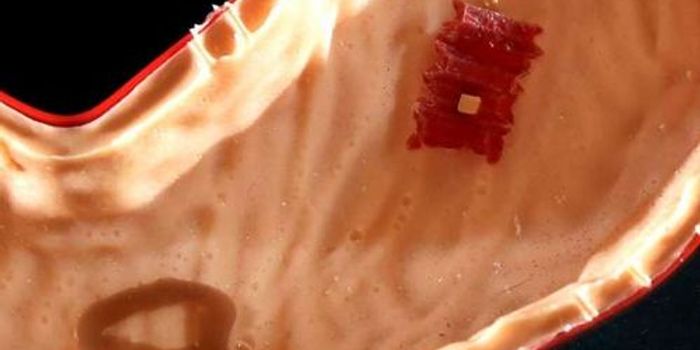 Stomach Trouble? Try the 'Robot in a Pill'